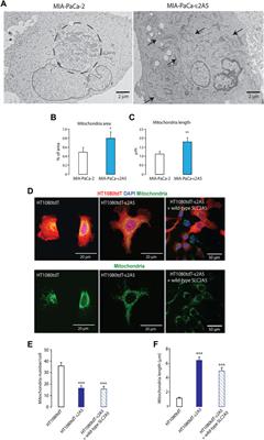 Loss of the fructose transporter SLC2A5 inhibits cancer cell migration